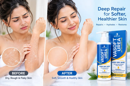 Viasoft Urea Moisturizing Lotion for Very Dry Skin | Deep Hydration & Advanced Skin Barrier Repair | With Urea, Shea Butter & Ceramide NP | Non-Sticky Body Lotion | 200 m