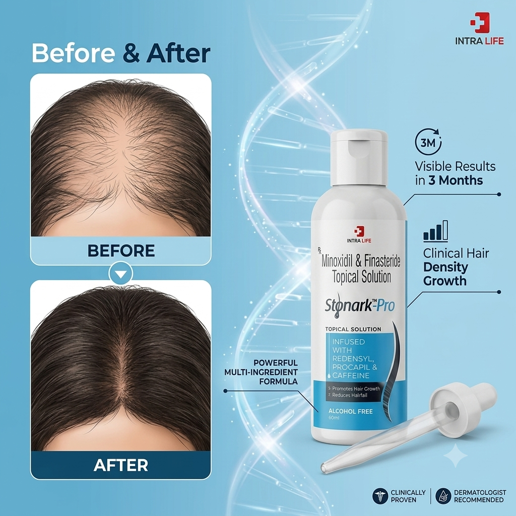 Stonark Pro Topical Solution 60ml