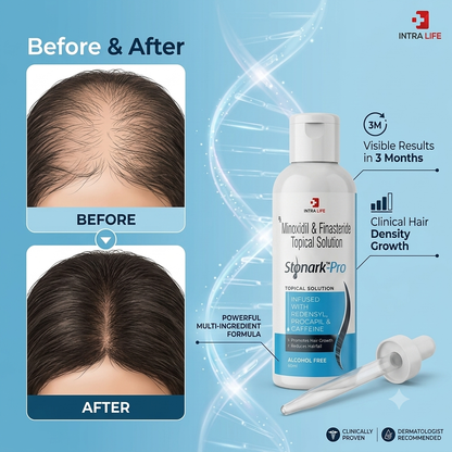 Stonark Pro Topical Solution 60ml